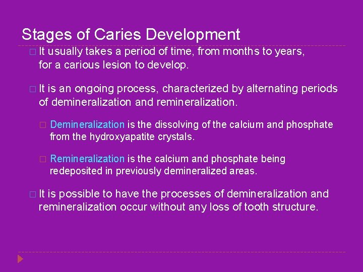Stages of Caries Development � It usually takes a period of time, from months