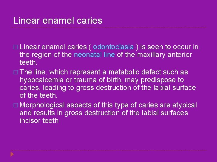 Linear enamel caries � Linear enamel caries ( odontoclasia ) is seen to occur