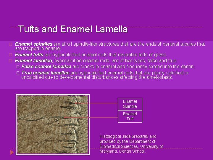 Tufts and Enamel Lamella � � � Enamel spindles are short spindle-like structures that