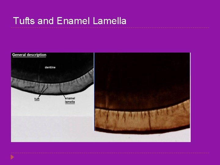 Tufts and Enamel Lamella 