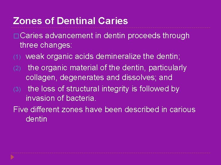 Zones of Dentinal Caries � Caries advancement in dentin proceeds through three changes: (1)