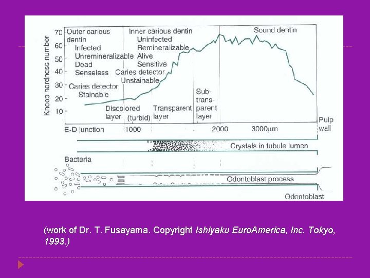 (work of Dr. T. Fusayama. Copyright Ishiyaku Euro. America, Inc. Tokyo, 1993. ) 