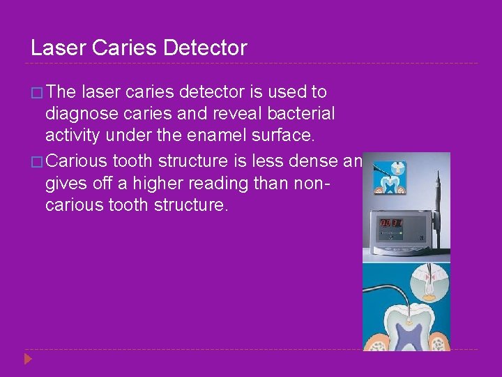 Laser Caries Detector � The laser caries detector is used to diagnose caries and