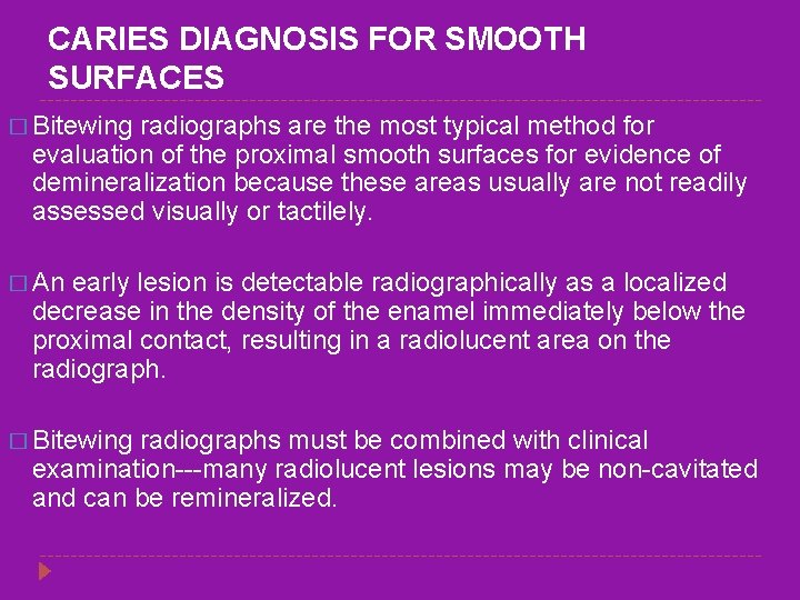 CARIES DIAGNOSIS FOR SMOOTH SURFACES � Bitewing radiographs are the most typical method for