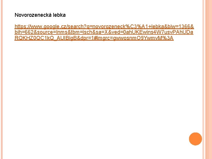 Novorozenecká lebka https: //www. google. cz/search? q=novorozeneck%C 3%A 1+lebka&biw=1366& bih=662&source=lnms&tbm=isch&sa=X&ved=0 ah. UKEwins 4 W