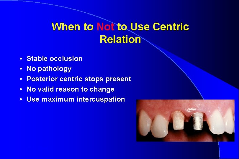 When to Not to Use Centric Relation • • • Stable occlusion No pathology