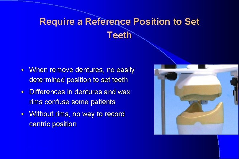 Require a Reference Position to Set Teeth • When remove dentures, no easily determined