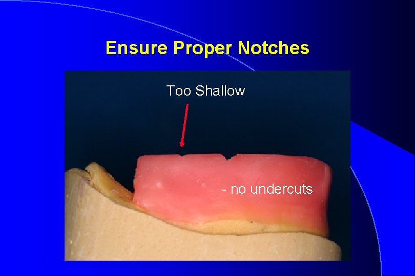 Ensure Proper Notches Too Shallow - no undercuts Robert W. Loney 