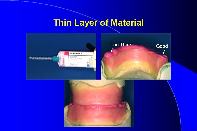 Thin Layer of Material Too Thick Robert W. Loney Good 