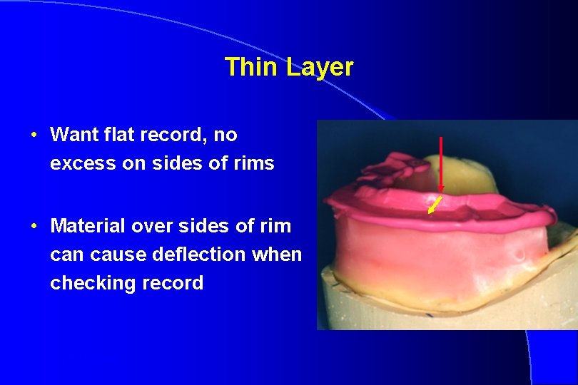 Thin Layer • Want flat record, no excess on sides of rims • Material