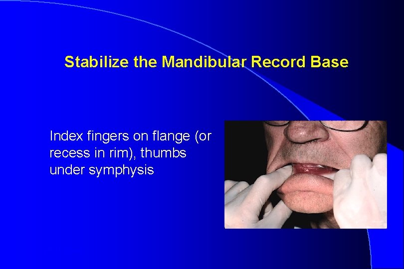 Stabilize the Mandibular Record Base Index fingers on flange (or recess in rim), thumbs