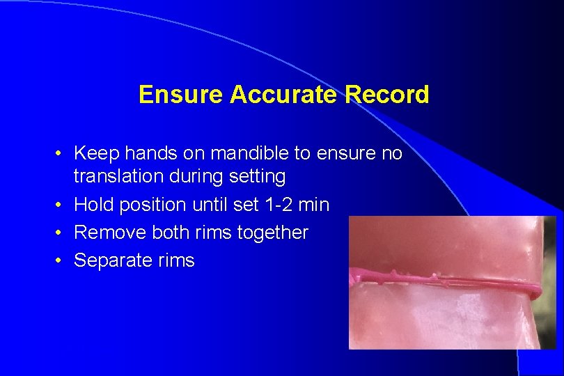 Ensure Accurate Record • Keep hands on mandible to ensure no translation during setting