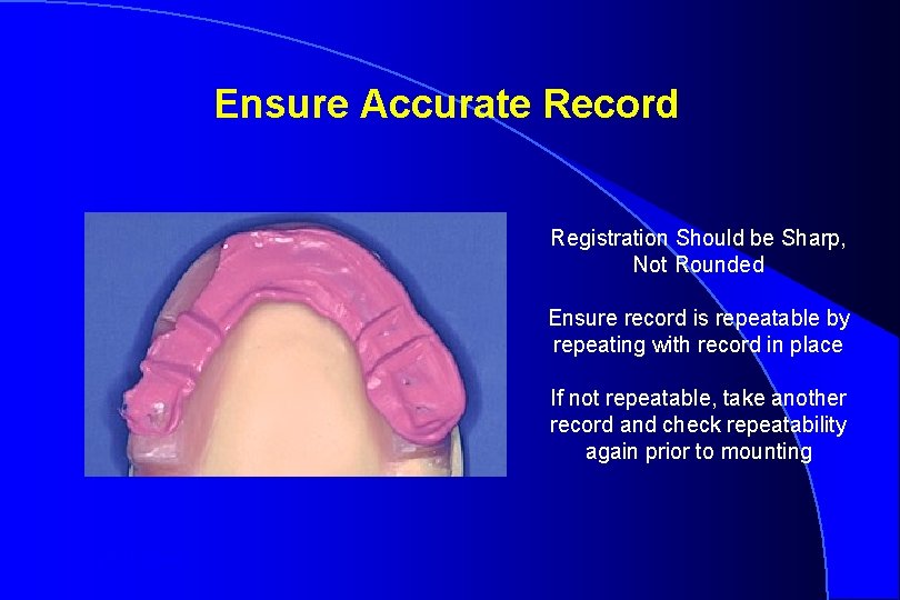 Ensure Accurate Record Registration Should be Sharp, Not Rounded Ensure record is repeatable by