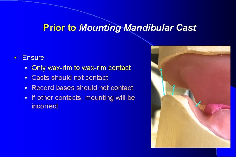 Prior to Mounting Mandibular Cast • Ensure • Only wax-rim to wax-rim contact •