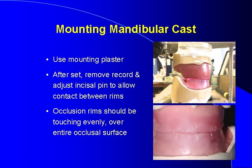 Mounting Mandibular Cast • Use mounting plaster • After set, remove record & adjust