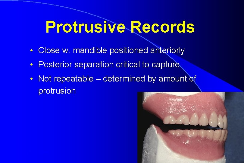 Protrusive Records • Close w. mandible positioned anteriorly • Posterior separation critical to capture