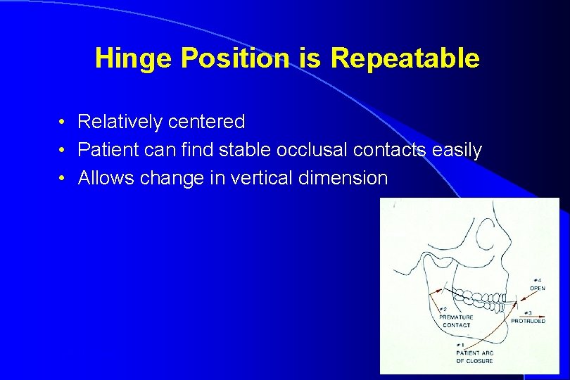 Hinge Position is Repeatable • Relatively centered • Patient can find stable occlusal contacts