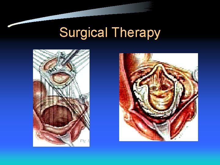 Surgical Therapy 