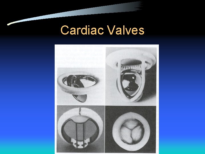 Cardiac Valves 