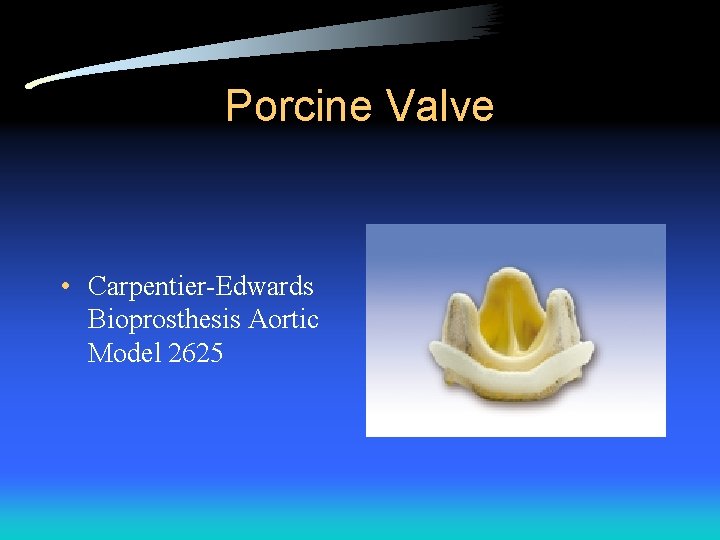 Porcine Valve • Carpentier-Edwards Bioprosthesis Aortic Model 2625 