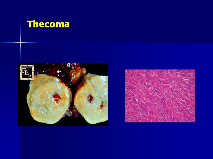 Thecoma 