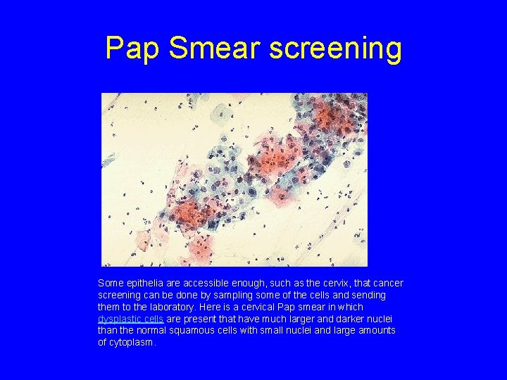 Pap Smear screening Some epithelia are accessible enough, such as the cervix, that cancer