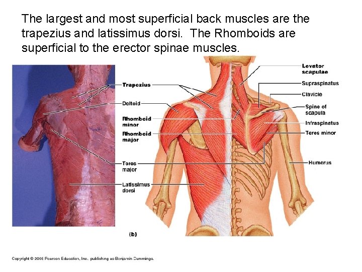 The largest and most superficial back muscles are the trapezius and latissimus dorsi. The