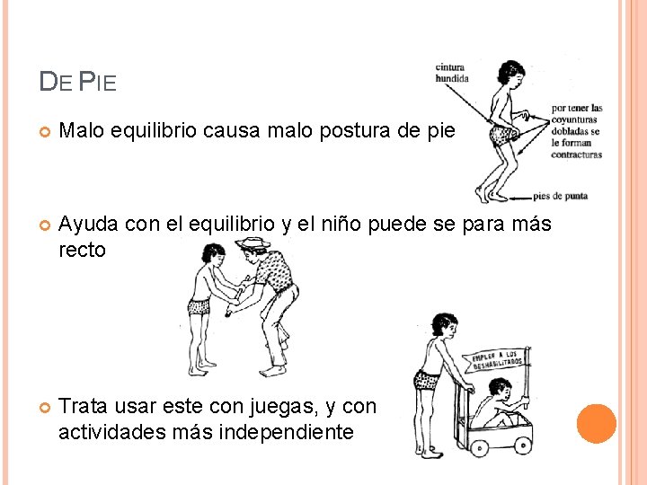 DE PIE Malo equilibrio causa malo postura de pie Ayuda con el equilibrio y