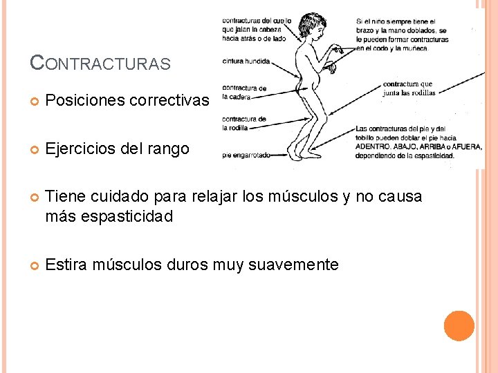 CONTRACTURAS Posiciones correctivas Ejercicios del rango Tiene cuidado para relajar los músculos y no