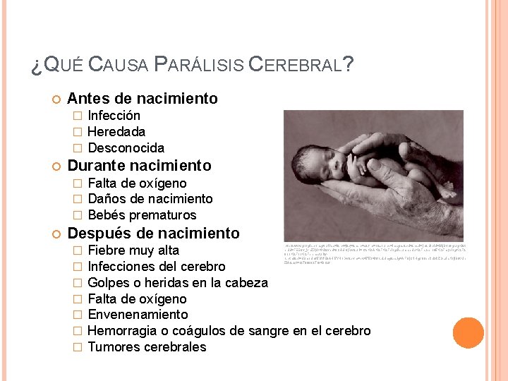 ¿QUÉ CAUSA PARÁLISIS CEREBRAL? Antes de nacimiento � � � Durante nacimiento � �