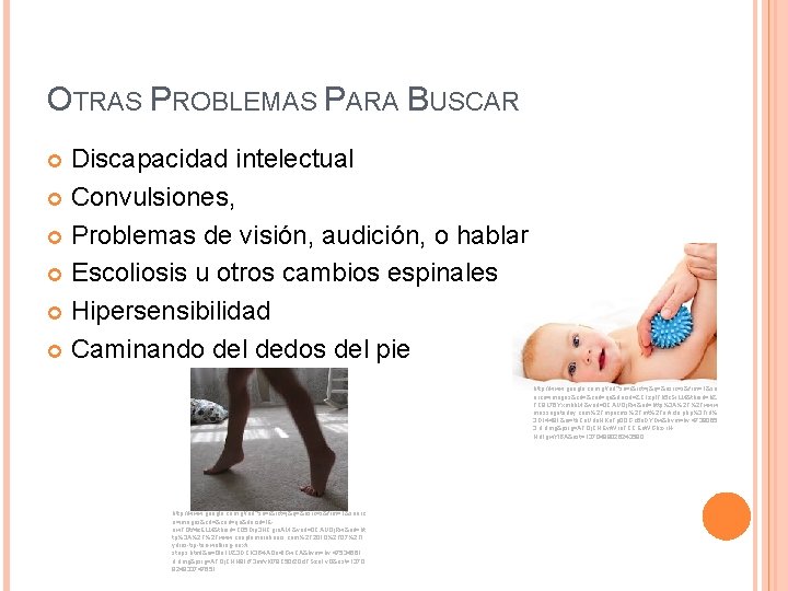 OTRAS PROBLEMAS PARA BUSCAR Discapacidad intelectual Convulsiones, Problemas de visión, audición, o hablar Escoliosis