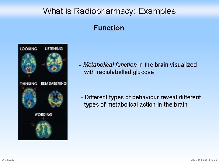 What is Radiopharmacy: Examples Function - Metabolical function in the brain visualized with radiolabelled