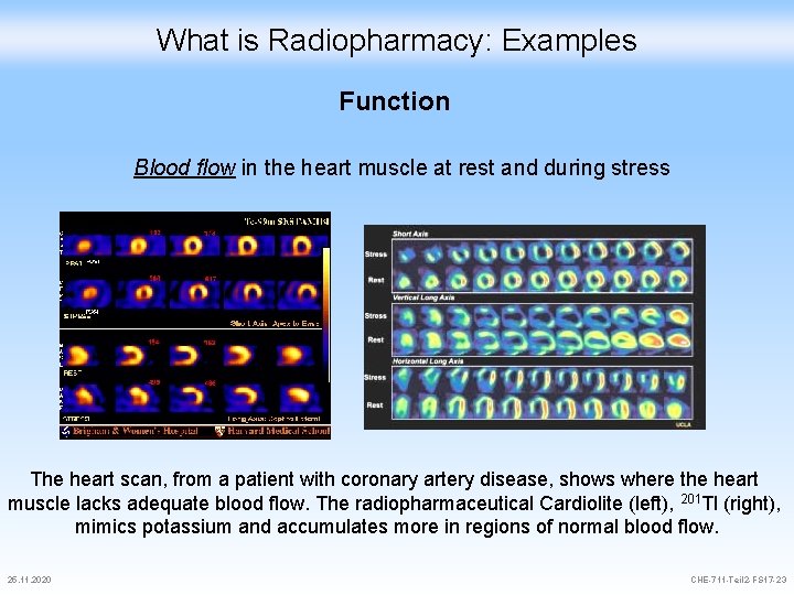 What is Radiopharmacy: Examples Function Blood flow in the heart muscle at rest and