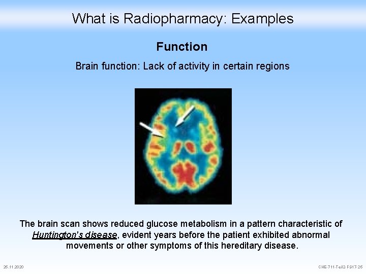 What is Radiopharmacy: Examples Function Brain function: Lack of activity in certain regions The