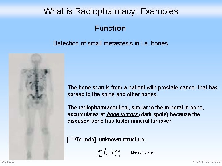 What is Radiopharmacy: Examples Function Detection of small metastesis in i. e. bones The