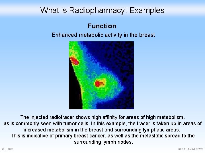 What is Radiopharmacy: Examples Function Enhanced metabolic activity in the breast The injected radiotracer
