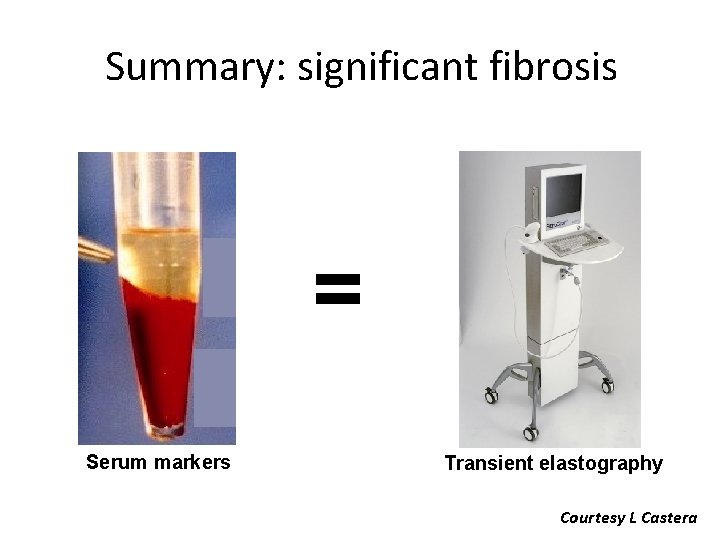 Summary: significant fibrosis = Serum markers Transient elastography Courtesy L Castera 