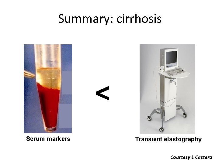 Summary: cirrhosis < Serum markers Transient elastography Courtesy L Castera 
