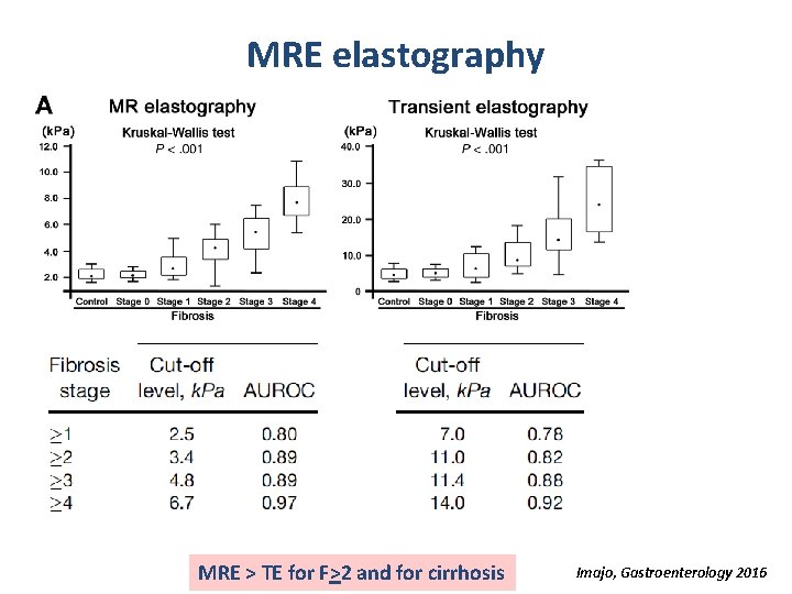 MRE elastography MRE > TE for F>2 and for cirrhosis Imajo, Gastroenterology 2016 
