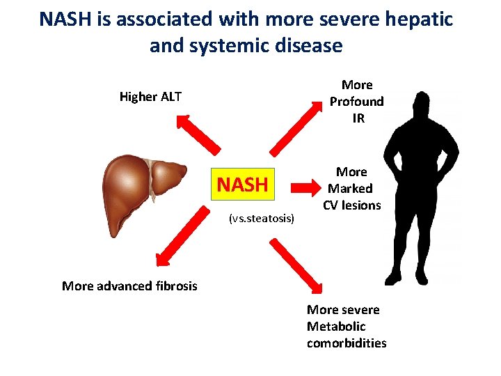 NASH is associated with more severe hepatic and systemic disease More Profound IR Higher