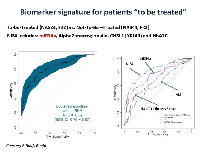 Biomarker signature for patients “to be treated” To-be-Treated (NAS≥ 4, F≥ 2) vs. Not-To-Be
