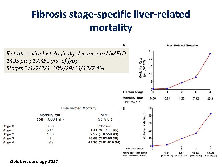 Fibrosis stage-specific liver-related mortality 5 studies with histologically documented NAFLD 1495 pts ; 17,
