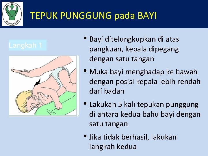 TEPUK PUNGGUNG pada BAYI Langkah 1 • Bayi ditelungkupkan di atas pangkuan, kepala dipegang