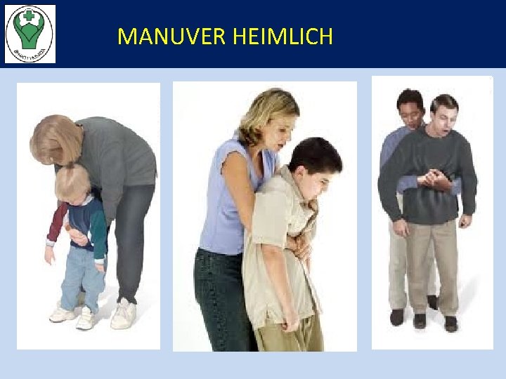 MANUVER HEIMLICH 