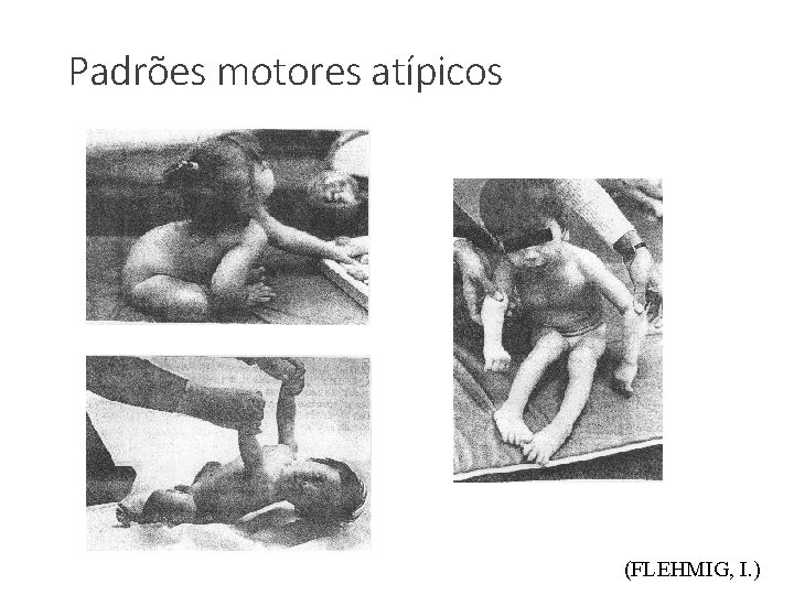 Padrões motores atípicos (FLEHMIG, I. ) 