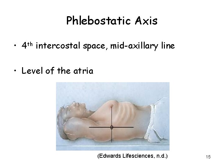 Phlebostatic Axis • 4 th intercostal space, mid-axillary line • Level of the atria