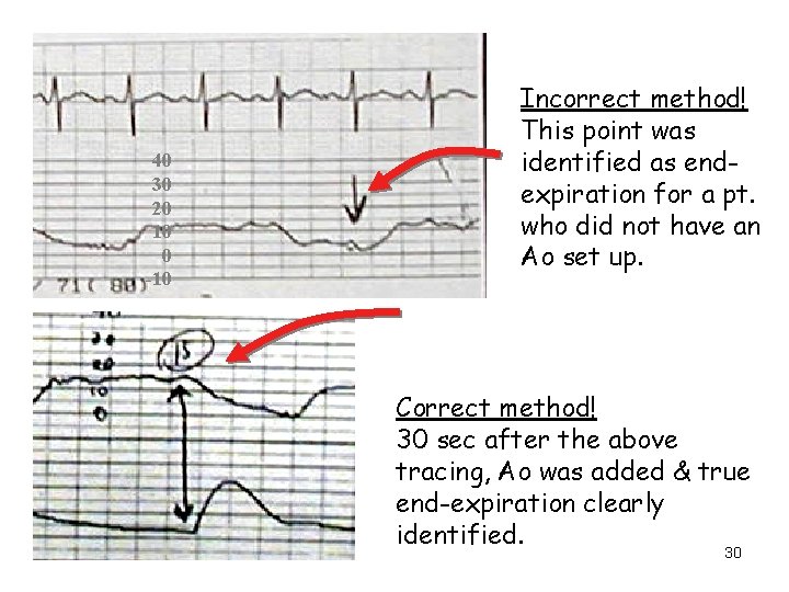 40 30 20 10 0 -10 Incorrect method! This point was identified as endexpiration