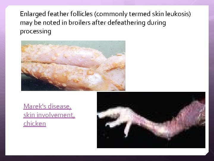 Enlarged feather follicles (commonly termed skin leukosis) may be noted in broilers after defeathering