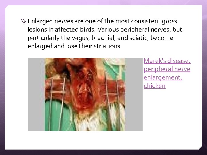  Enlarged nerves are one of the most consistent gross lesions in affected birds.