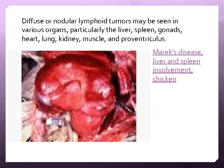 Diffuse or nodular lymphoid tumors may be seen in various organs, particularly the liver,